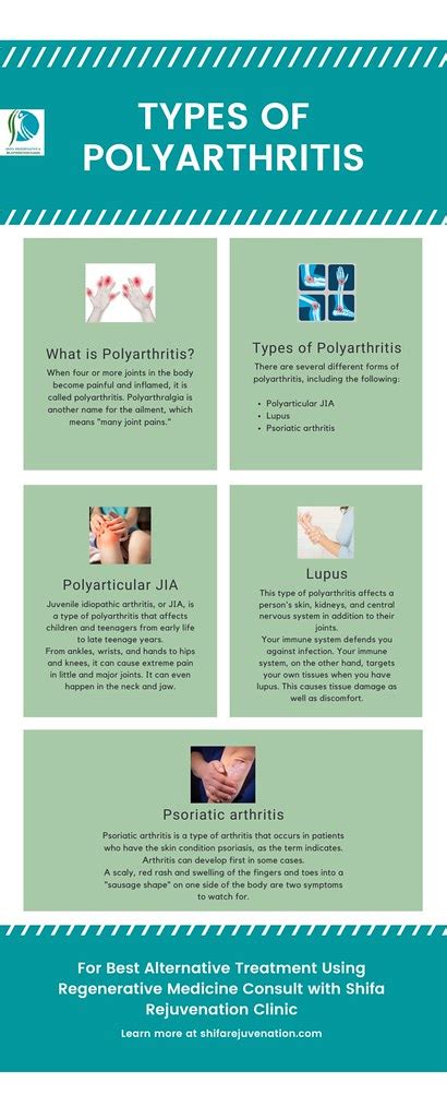 Types of polyarthritis | When four or more joints in the bod… | Flickr