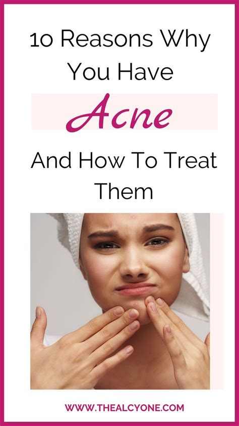 Reasons Why You Have Acne And How To Treat Acne Artofit