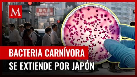 Bacteria carnívora genera preocupación en Japón por cifras de infección