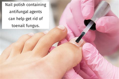 6 Home Remedies For Toenail Fungus Emedihealth