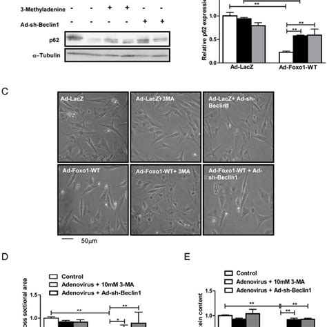 Autophagy Inhibition Attenuates Foxo1 Induced Reduction In Cell Size