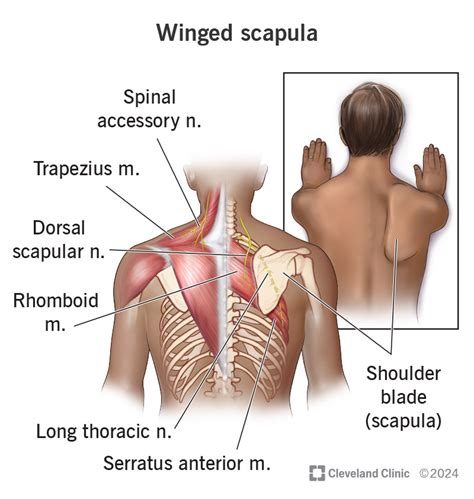 Winged Scapula: Causes, Symptoms, Tests & Treatment