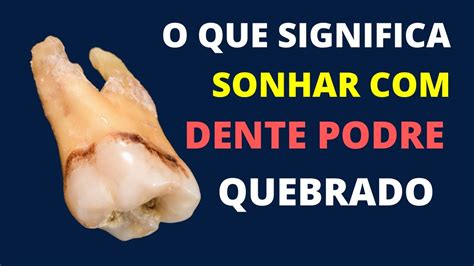 Sonhar Dente Podre E Quebrado Saiba O Significado YouTube