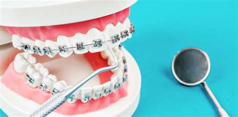 Orthodontic Myths Debunked Level Orthodontics