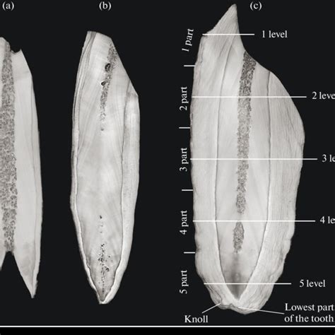 Longitudinal sections of the upper teeth of walruses: (a) a I 3 tooth... | Download Scientific ...