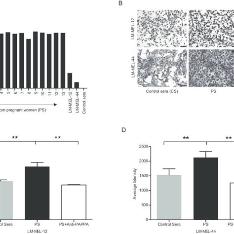 Pregnant Serum Enhances Migratory Capability Of Melanoma Cell Lines In