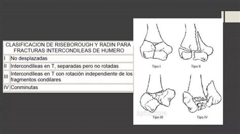 Fractura De Epicondilo Medial Y Lateral Pptx