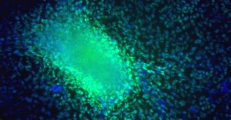 Ecms And Biologically Coated Surfaces Extracellular Matrices Corning