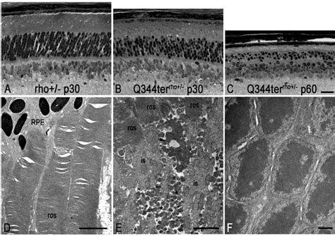 Figure 2 From Q344ter Mutation Causes Mislocalization Of Rhodopsin