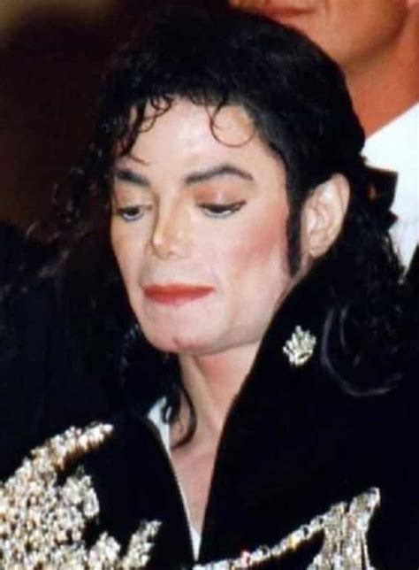 Celebrities You Didn't Know Have Vitiligo