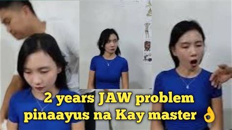 2 Years Jaw Problem 😱😱 Masakit Daw Pag Nganga Nya Youtube