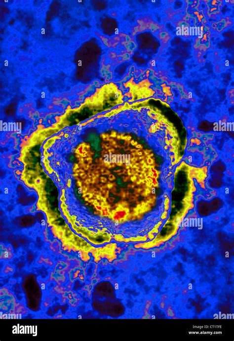 Herpes Simplex Virus Stock Photo Alamy