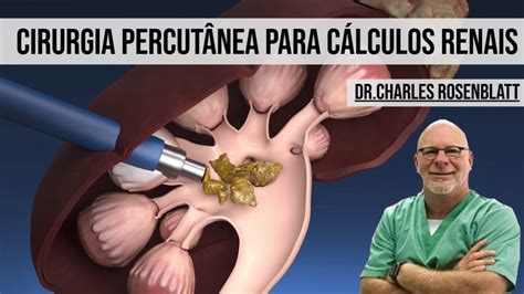 Cirurgia Percut Nea Para C Lculos Renais Youtube