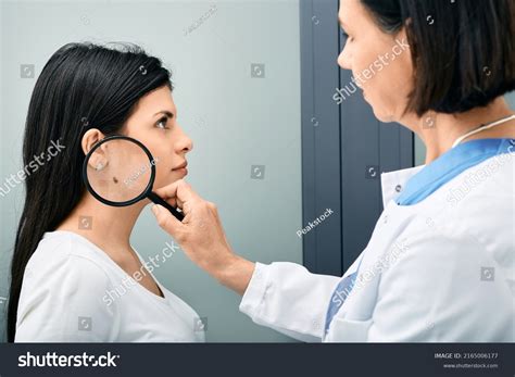 Mole Dermoscopy Preventive Melanoma Doctor Examining Stock Photo