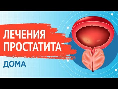 Таблетки от простатита ⋆ Список самых эффективных препаратов ⋆ (5 видео)