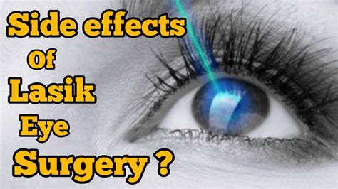 Side Effects Of Lasik Eye Surgery Side Effects Of Laser Eye Surgery Youtube