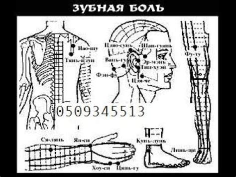 Электронника Чэнс-2М хроническая боль помощь лечение +380501704119 ...