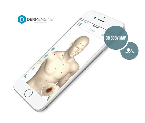 Total Body Mole Mapping With Dermengine