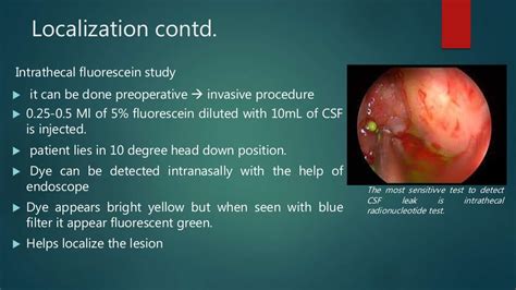 Csf Rhinorrhea Overview