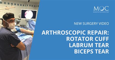 New video: Arthroscopic Rotator Cuff Repar | Manhattan Orthopedic Care