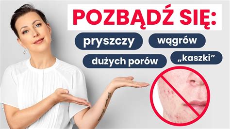 Pryszcze W Gry Wiecenie Przyczyny I Skuteczne Metody Na Pozbycie