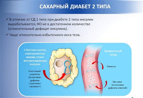 Сахарный диабет второго типа - лечение в Германии