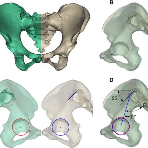 Techniques Of Image Processing And Measurement Of Spinopelvic