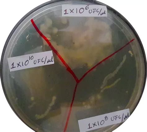 Bacteria Biodigestora Trampa De Grasa Drenajes Y Fosas Kg En