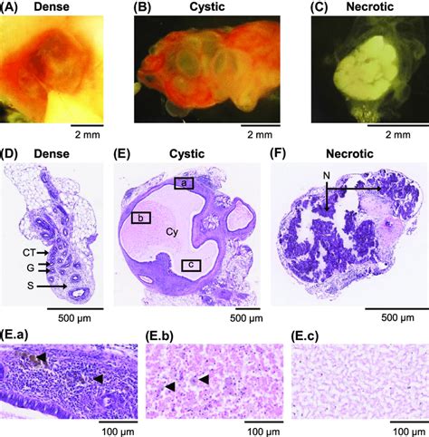 Macroscopic And Histological Characteristics Of Endometriosis Like