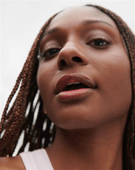 lip line blackhead on lip 6