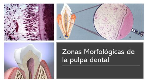 Zonas morfológicas de la pulpa Dental YouTube