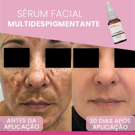 Sérum Facial Clareador Ácido Mandélico 4 3 Alpha Arbutim Submarino