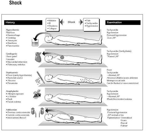 Shock:types and signs | Nursing school survival, Emergency nursing ...