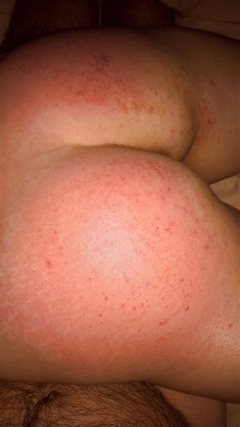 My Clamped Tits Paddled Nude Pics XHamster