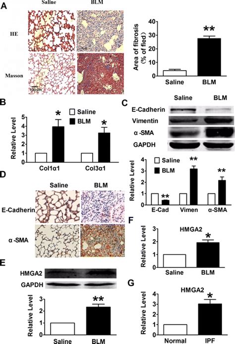 Dysregulation Of Emt Pathway In The Lungs Of Mice With Experimental