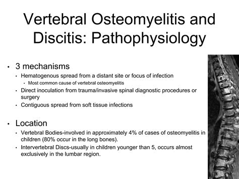 Discitis And Osteomyelitis In Sickle Cell Disease Ppt