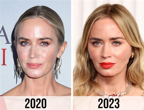 Emily Blunt Plastic Surgery Before After Plasticsurgeryinsights