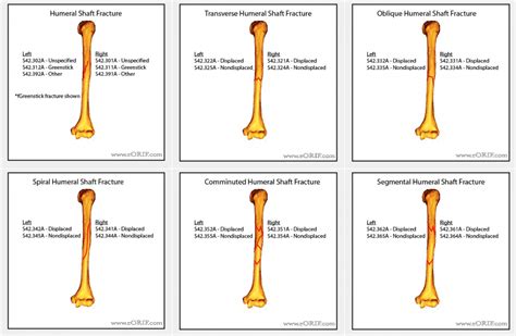 Icd 10 Code For Humerus Injury