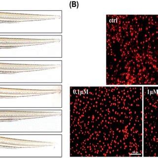 Sts Regulates Melanocytic Filopodia Formation To Increase Melanosome