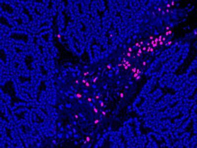 TUNEL Assay Apoptosis Detection Kit - Biotium