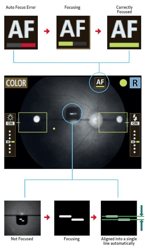 CR 2 PLUS AF Digital Non Mydriatic Retinal Camera Eye Care Canon