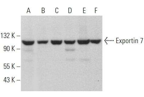 Exportin 7抗体 A 11 SCBT Santa Cruz Biotechnology