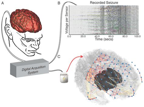 Clinical Translation Of Network Neuroscience Tools Network