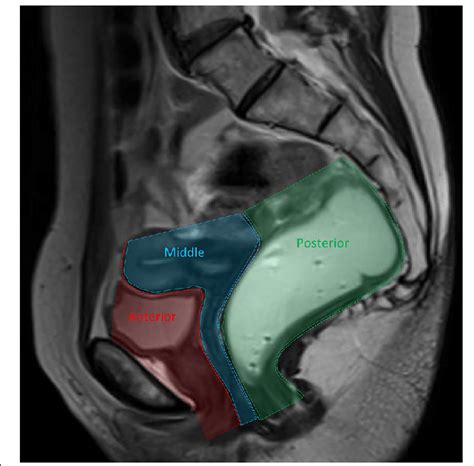 Sagittal Diagram Of The Female Pelvis The Anterior Compartment Images