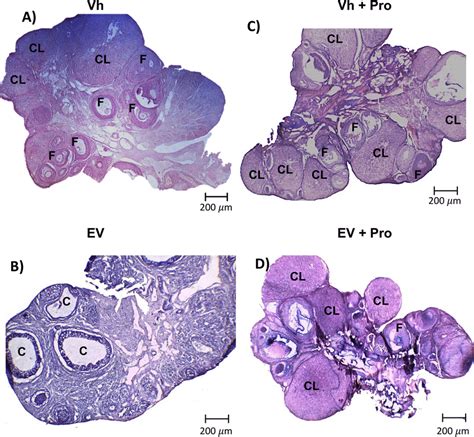 Ovarian Morphology In Ev Induced Pcos Rats After Blocking The Ovarian