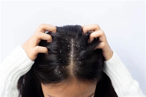 Head Lice Treatment For Sensitive Skin Your Guide Licedoctors