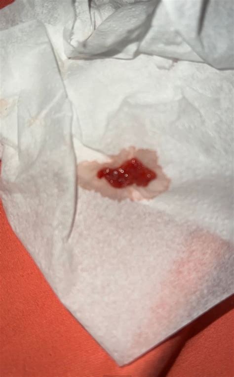 Blood after intercourse?? | BabyCenter
