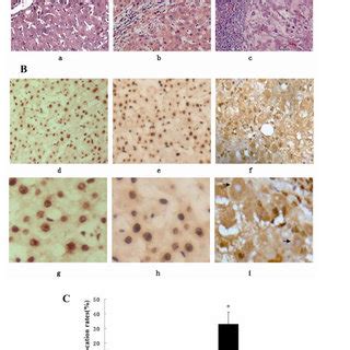 Lps And Tnf Stimulated Hepg Cells To Release Hmgb In A Time And