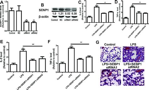 Senp1 Knockdown Ameliorates Lps Induced Sepsis A And B The Knockdown