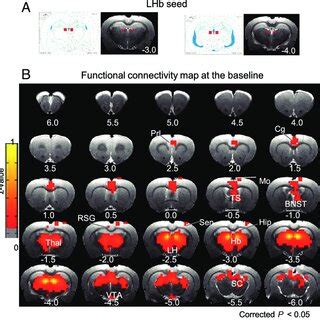 Lhb Seed Definition And Functional Connectivity Map At Baseline A A